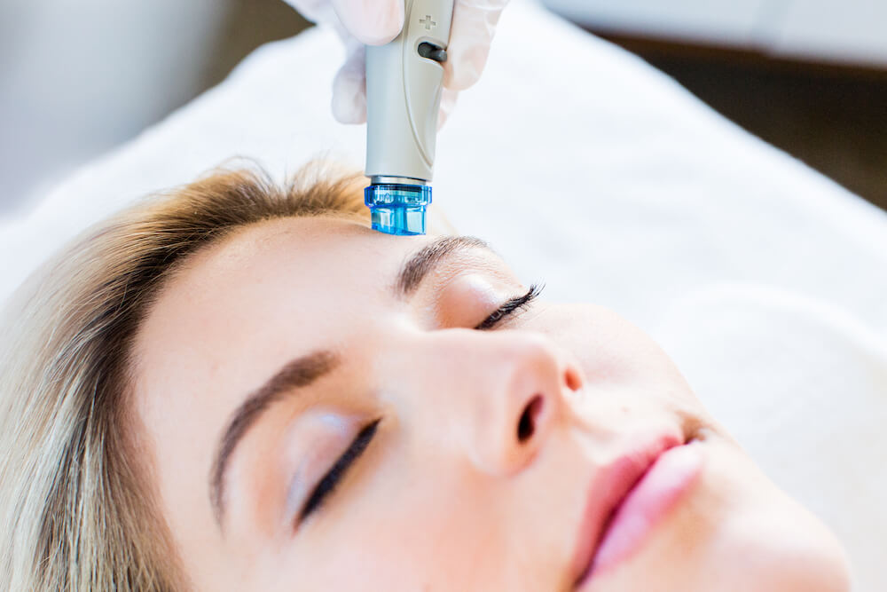 hydrafacial treatment being administered to woman's forehead